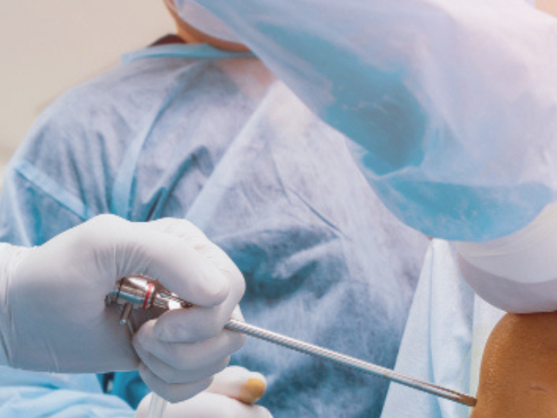 Artículo sobre Artroscopía de Tobillo ofrecido por Dr. Francisco Castillo Vazquez