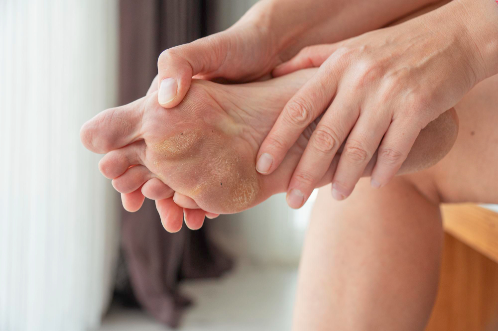 Artículo sobre Tratamiento de Metatarsalgia ofrecido por Dr. Francisco Castillo Vazquez